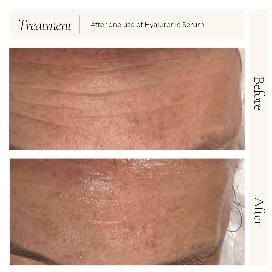 Hyaluronic Serum - Image 3